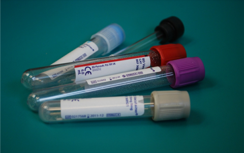 卫健委：居民可购买试剂自测新冠病毒抗原